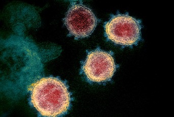 SARS-CoV-2病毒粒子的透射电镜图，可见冠状体。